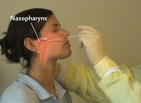 日本新冠抗体检测试剂盒,新冠病毒试剂盒还能用吗