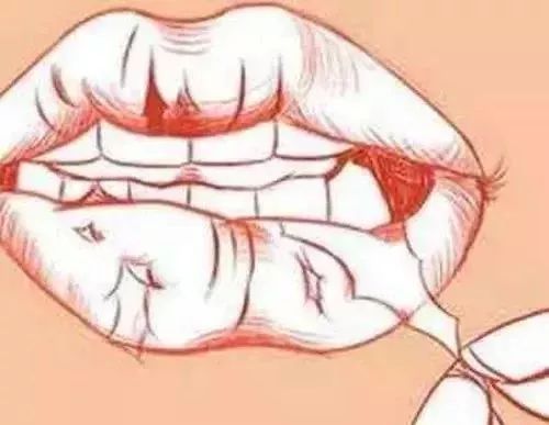 舔舔舔！唇炎找上门来怎么办？！