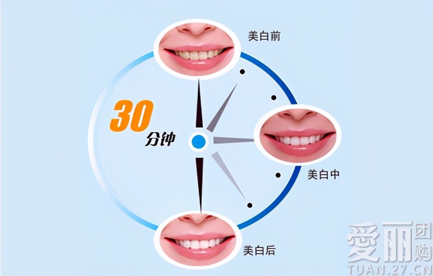 牙齿黄怎么办三招教你黄牙变白牙,黄牙黑牙真的能洗白吗