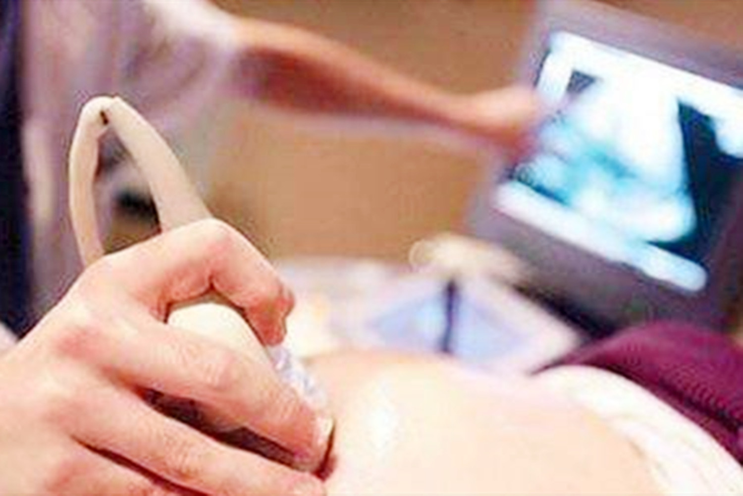 胎儿的性别是几周形成的,胎儿的性别是在什么时候形成的