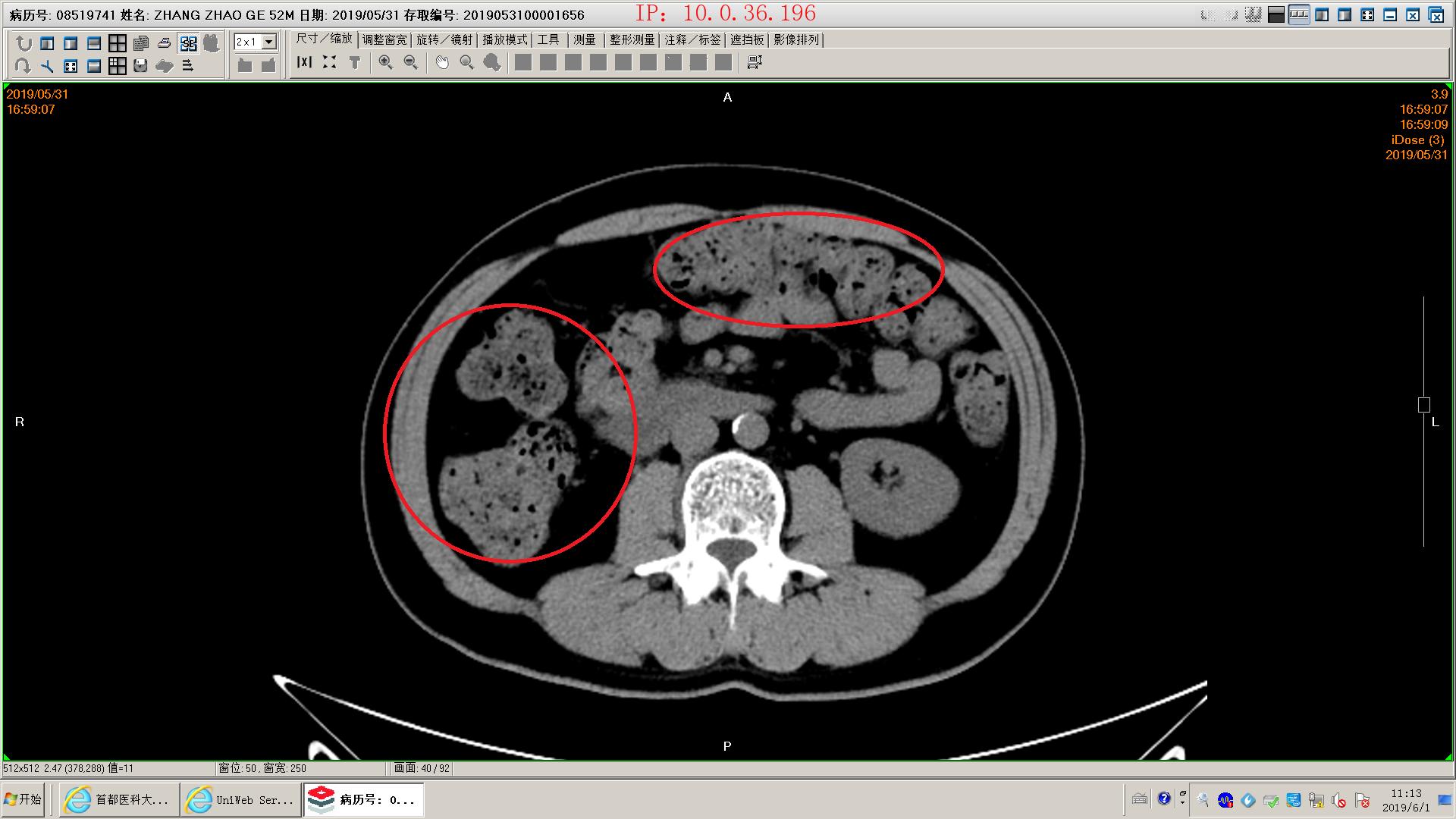 狗得了胰腺炎怎么办,狗得了胰腺炎治疗
