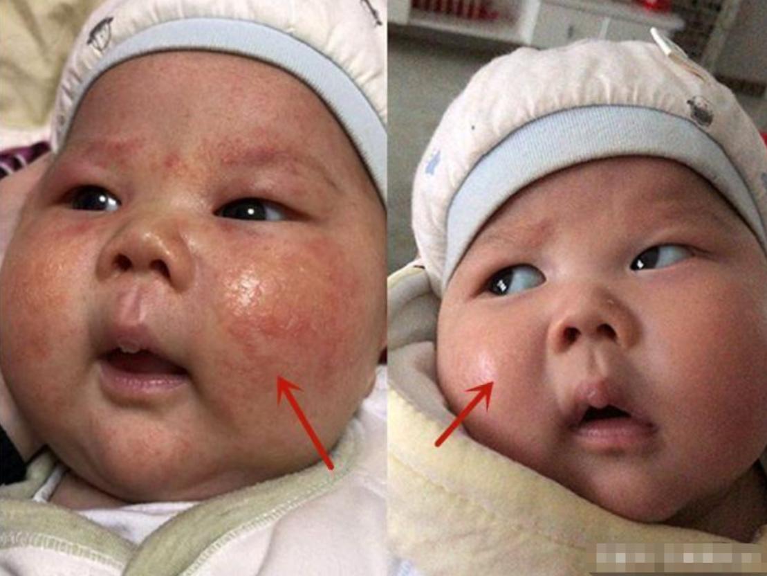 315曝光有毒尿不湿名单,央视曝光的毒尿不湿品牌有哪些