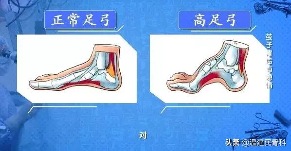 cctv2019年3月25日健康之路节目,cctv10健康之路4月1日回放