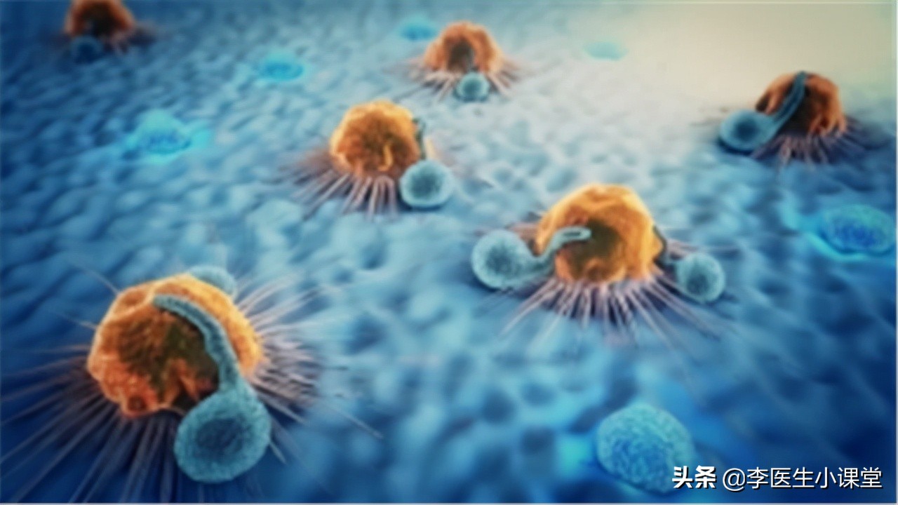 女子腰疼痛检查出宫颈癌,女子腰痛一个月竟是体内藏瘤