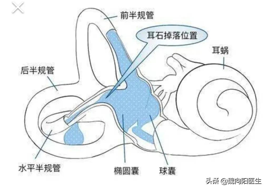 脑供血不足头晕输液用什么药,头晕眩晕需要输液吗