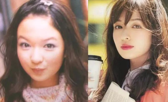 日本整容真的很好吗,日本整容vs韩国整容图片对比