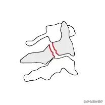 她被判处绞刑，吊了半小时却没死，这个医生说出了真相