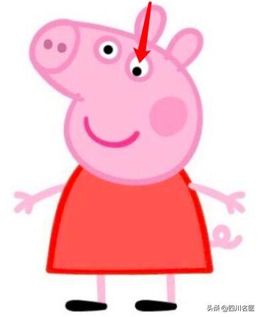 小孩弱视看东西歪头斜着看怎么办,孩子斜视看东西总歪头