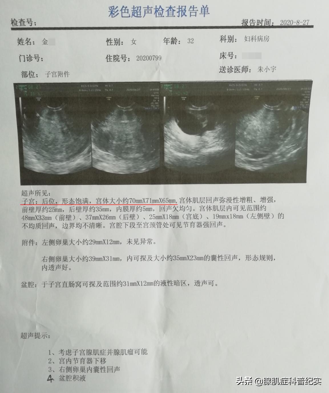 痛经做保宫手术有用吗,痛经能不能做微创手术