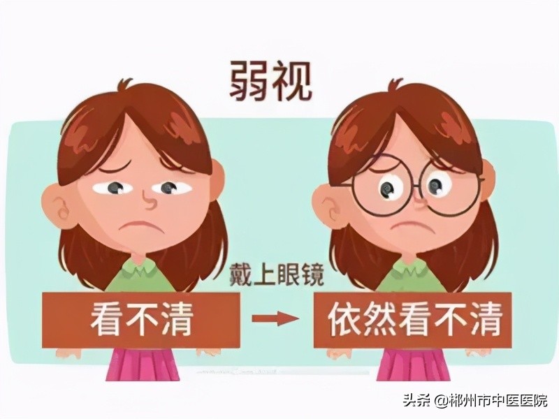 儿童视力弱视可以自愈吗,儿童视力低于1.0就是弱视