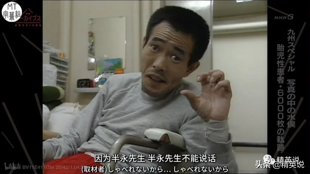 60多年前日本万人中毒成世界公害！如今福岛百万吨核废水入海…