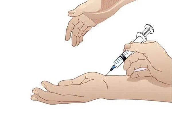 患了传说中的“妈妈手”怎么办,狭窄性腱鞘炎治疗看这里