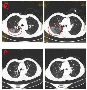 深圳第二人民医院疫情防控,深圳市第二人民医院抗疫情