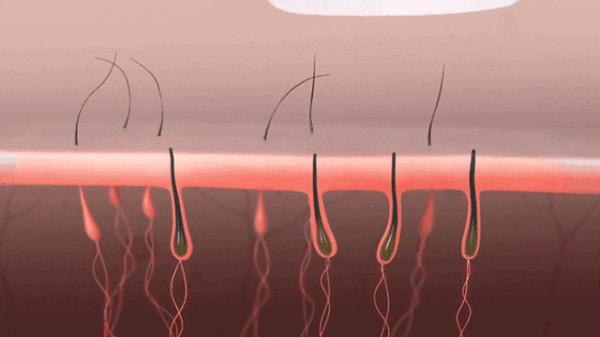 不做猕猴桃女孩是什么意思,不做猕猴桃女孩的图片