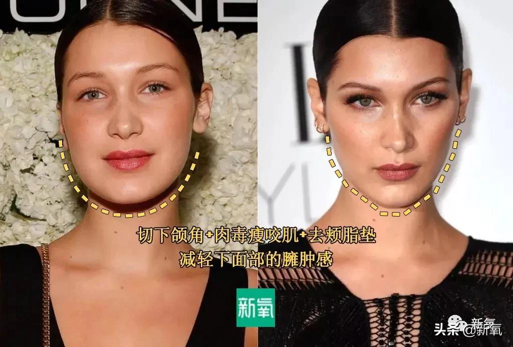 从万人嘲到万人捧,从万人嘲到万人迷