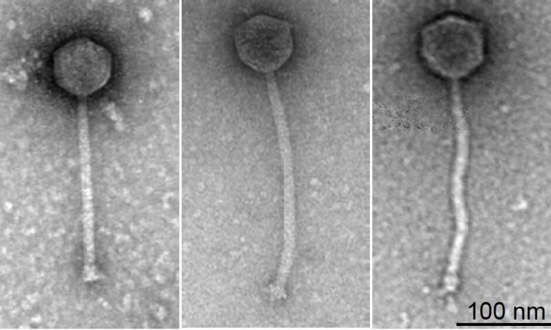 噬菌体疗法治疗患有耐药性细菌感染的患者