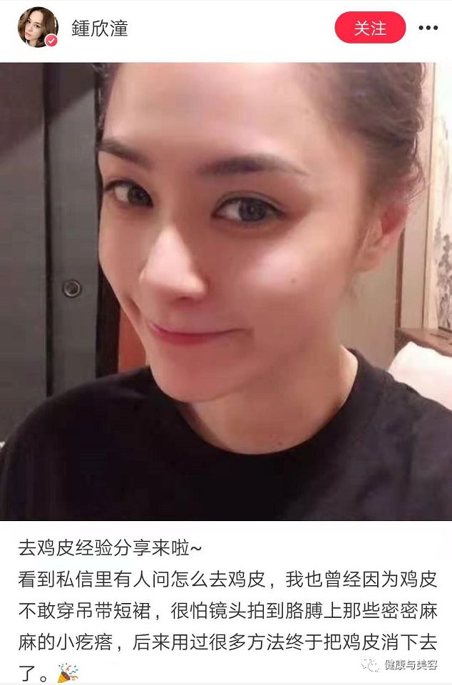 38岁阿娇沉迷于祛痘、去黑头的教学,居然很实用