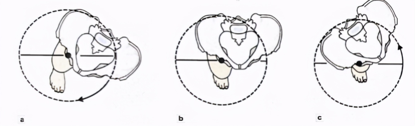 走着走着低头一看,裤子裙子跑偏了?来认领一下是否骨盆旋转