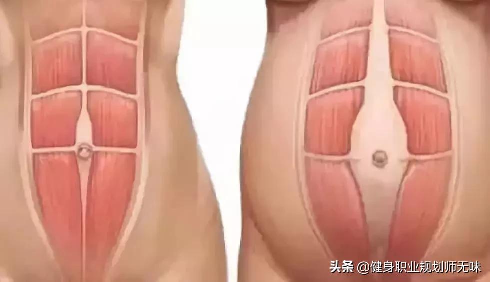 一招消灭大肚腩全程腹部收紧,肚子上的大肚腩怎样快速减去