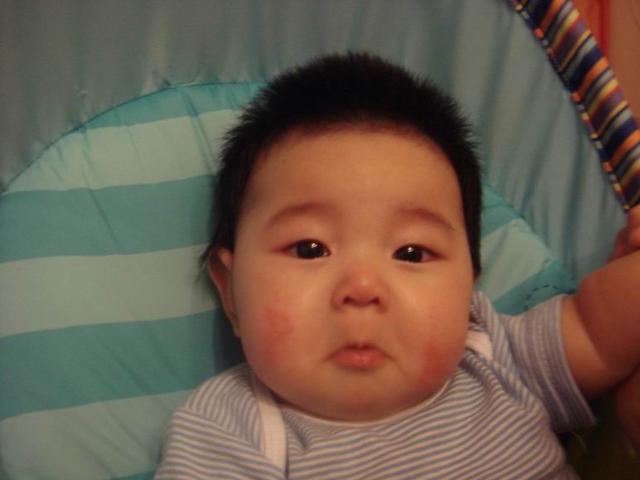 宝宝用酒精擦身退烧后有红点,3个月宝宝发烧酒精如何物理降温