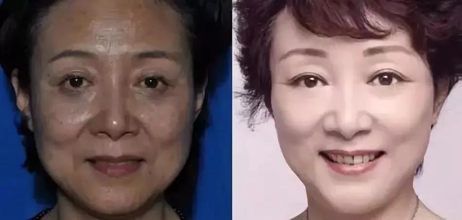 药店几块钱的维生素e能涂脸上嘛,药店几块钱的维生素e