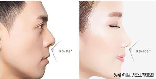 隆鼻也分性别,男女隆鼻差异知多少?