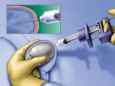 一文看懂医学影像科,一文读懂肝脏超声