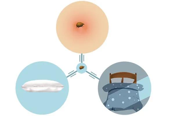 床上有螨虫用什么除螨药最好,床上如果有螨虫会怎么样