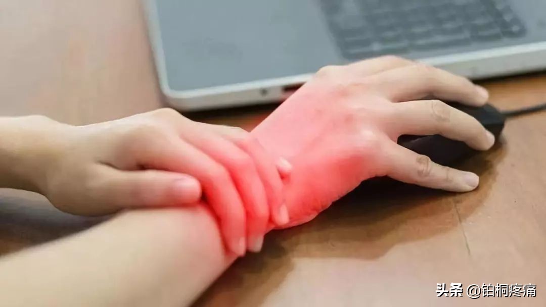 手麻、手痛、手无力？疼痛科一招帮您告别“鼠标手”