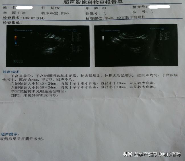 多囊好孕经验,多囊医生指导怀孕成功率有多高