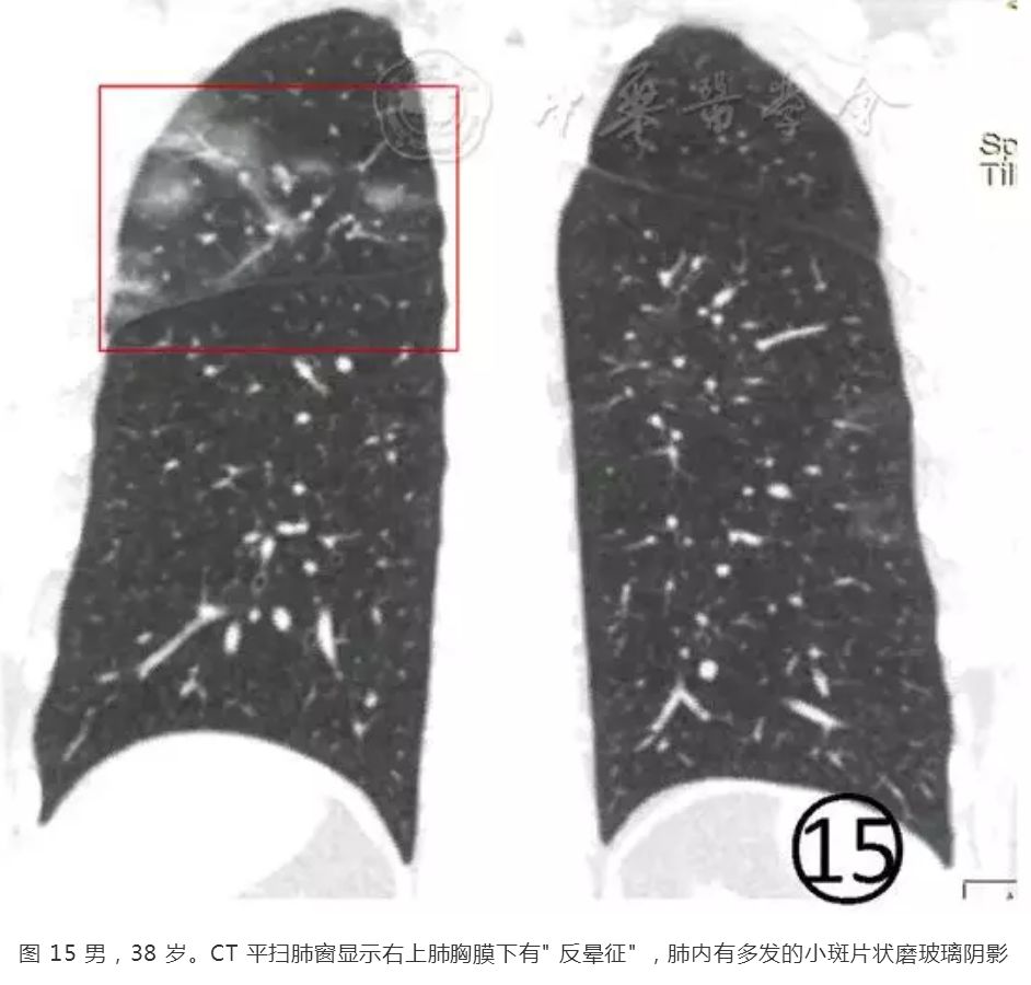 磨玻璃阴影怎么处理,磨玻璃阴影