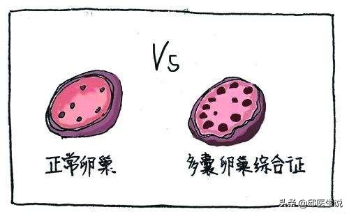 备孕医生建议减肥,邱医生说孕妇怎么减肥