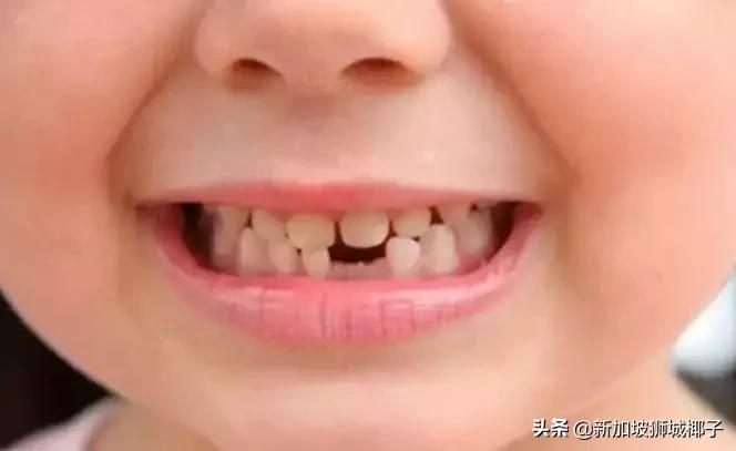 “我在新加坡带孩子看牙医，花了3000多新币！”