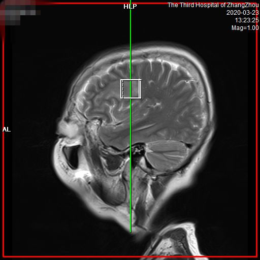 漳州市第三医院预约做磁共振,3.0t核磁共振广东哪里可以做
