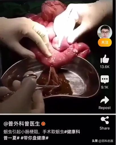 吃什么能驱逐蛔虫,判断肚子里有蛔虫的最好方法