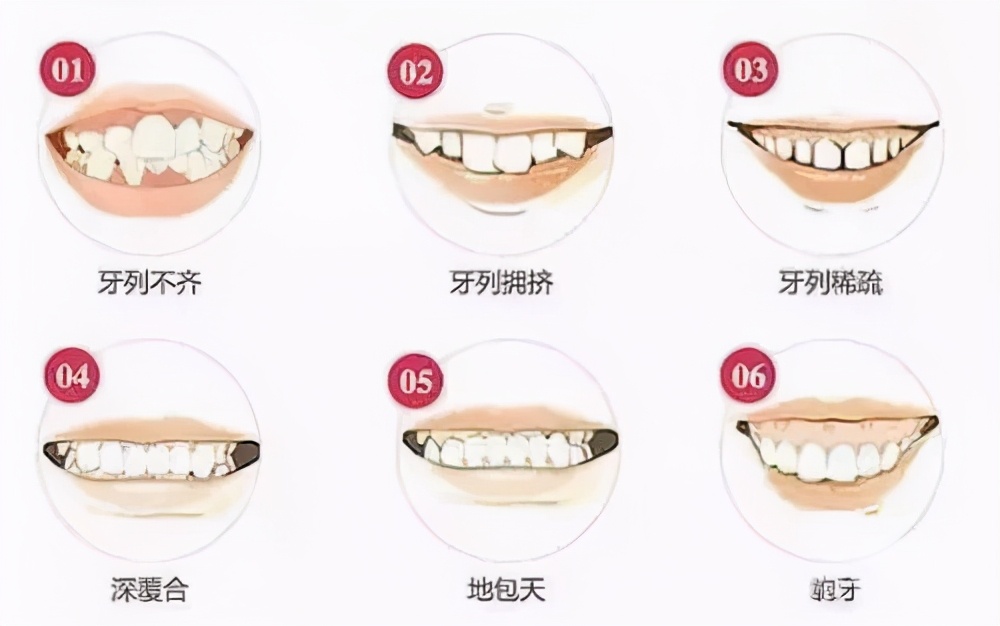 孩子的牙越来越小怎么回事,孩子牙齿又歪又大