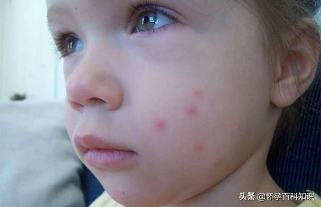 防蚊虫花露水管用吗,防蚊止痒花露水管用吗