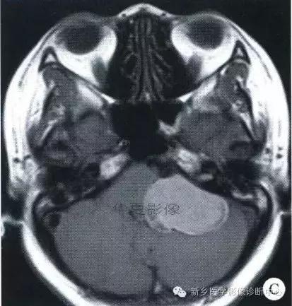 这些部位的黑色素瘤，您会诊断吗？
