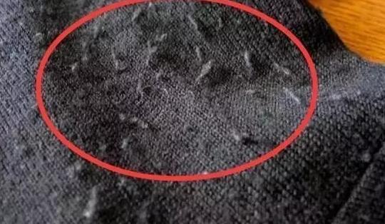 衣服洗完粘毛怎么办,有毛毛的衣服洗后怎么打理