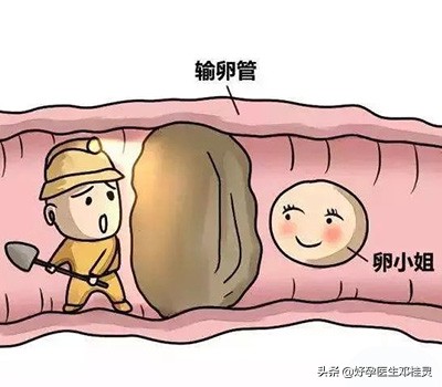 人流后痛经量少一定是宫腔粘连吗,人流后宫腔粘连吃中药会来月经吗