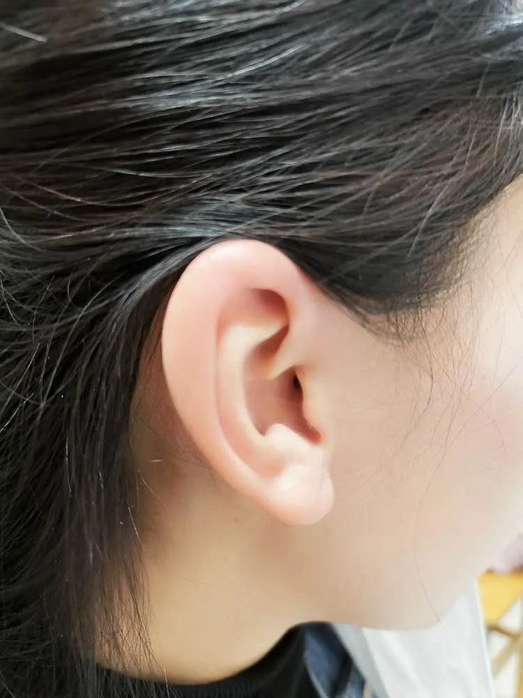 疫情过后耳朵声小听不见怎么回事,生病后耳朵听不见了怎么办