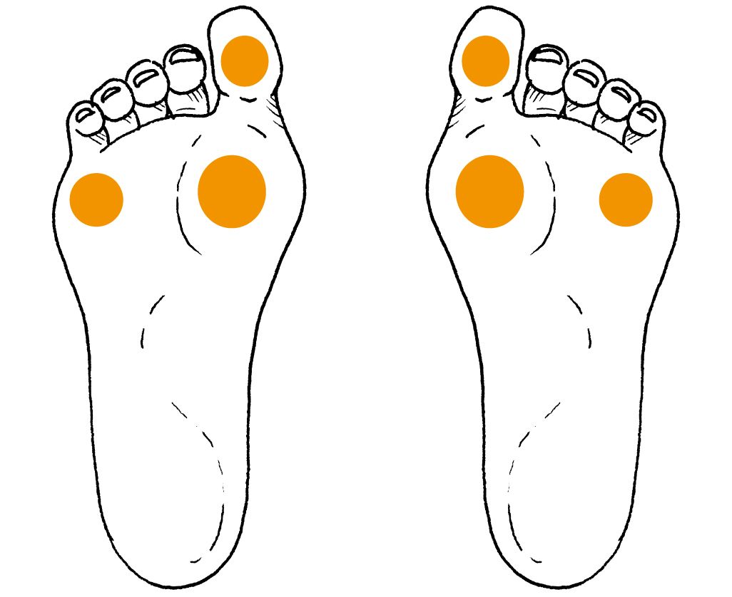 预防糖尿病足发生的正确方法,足部健康养生一切从脚开始
