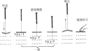 三衢杨氏补泻(十二字分次第手法及歌)