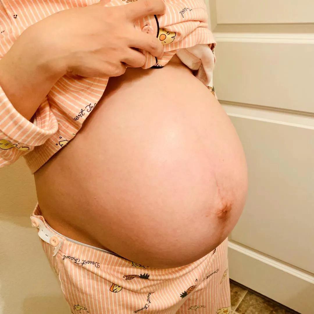 孕期预防妊娠纹精油排名,孕期防妊娠纹油推荐