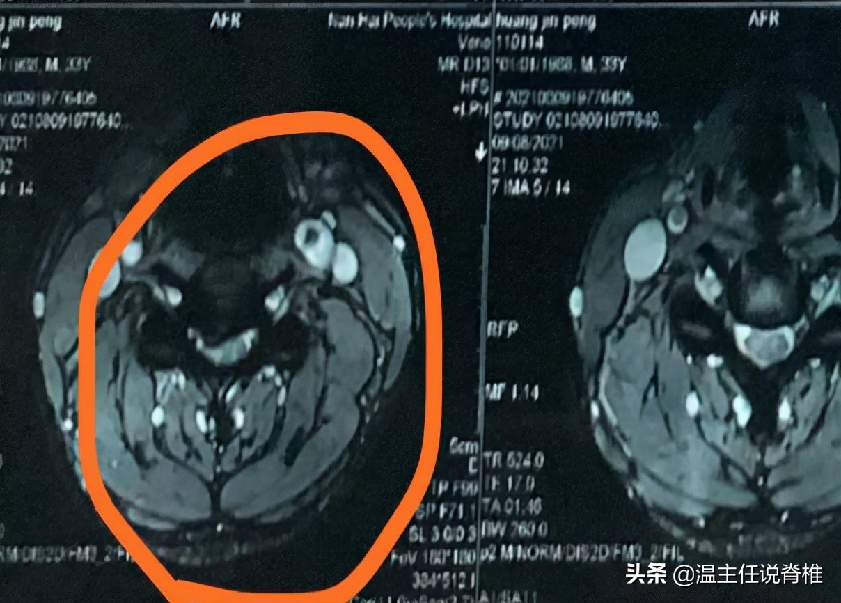 外科医生做脊椎手术,脊椎病保守治疗