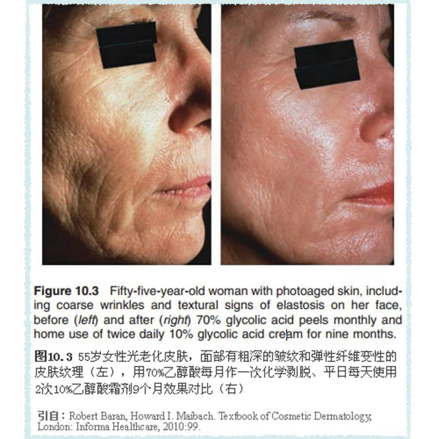 敏感肌痘痘肌大干皮统统看过来,敏感痘痘肌可以用什么产品