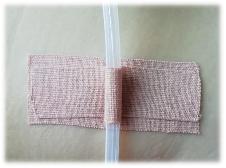 膀胱造瘘管居家护理的ppt,膀胱造瘘后在家如何护理