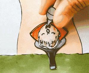 剖腹产后的我疼到难起身,竞走女王刘虹也如此,剖腹产到底有多难