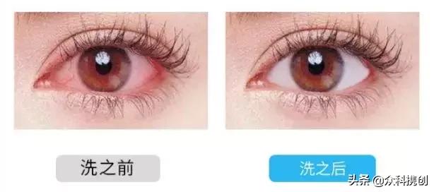 滴完眼药水多久可以洗澡,滴眼药水的时候要把眼睛洗干净吗