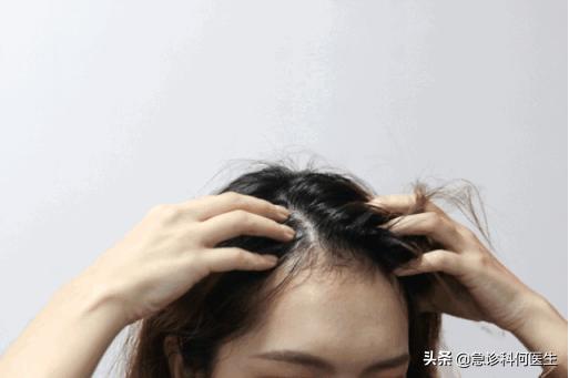 头发爱出油的正确处理方式,头发老出油怎么办最快最有效